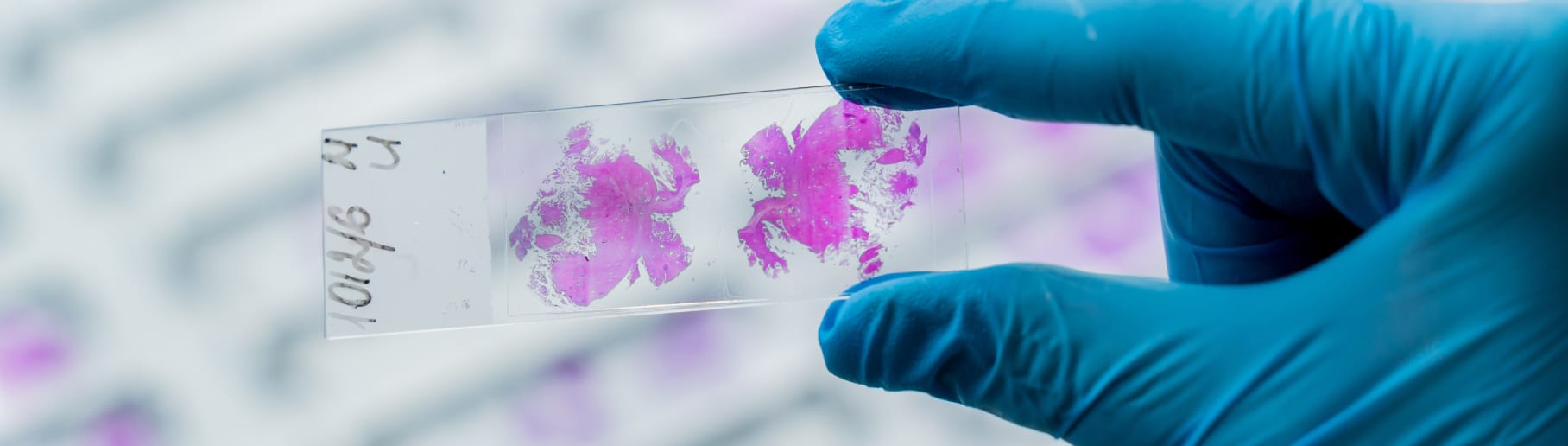 Foto eines gläsernen Objektträgers mit Gewebeprobe.